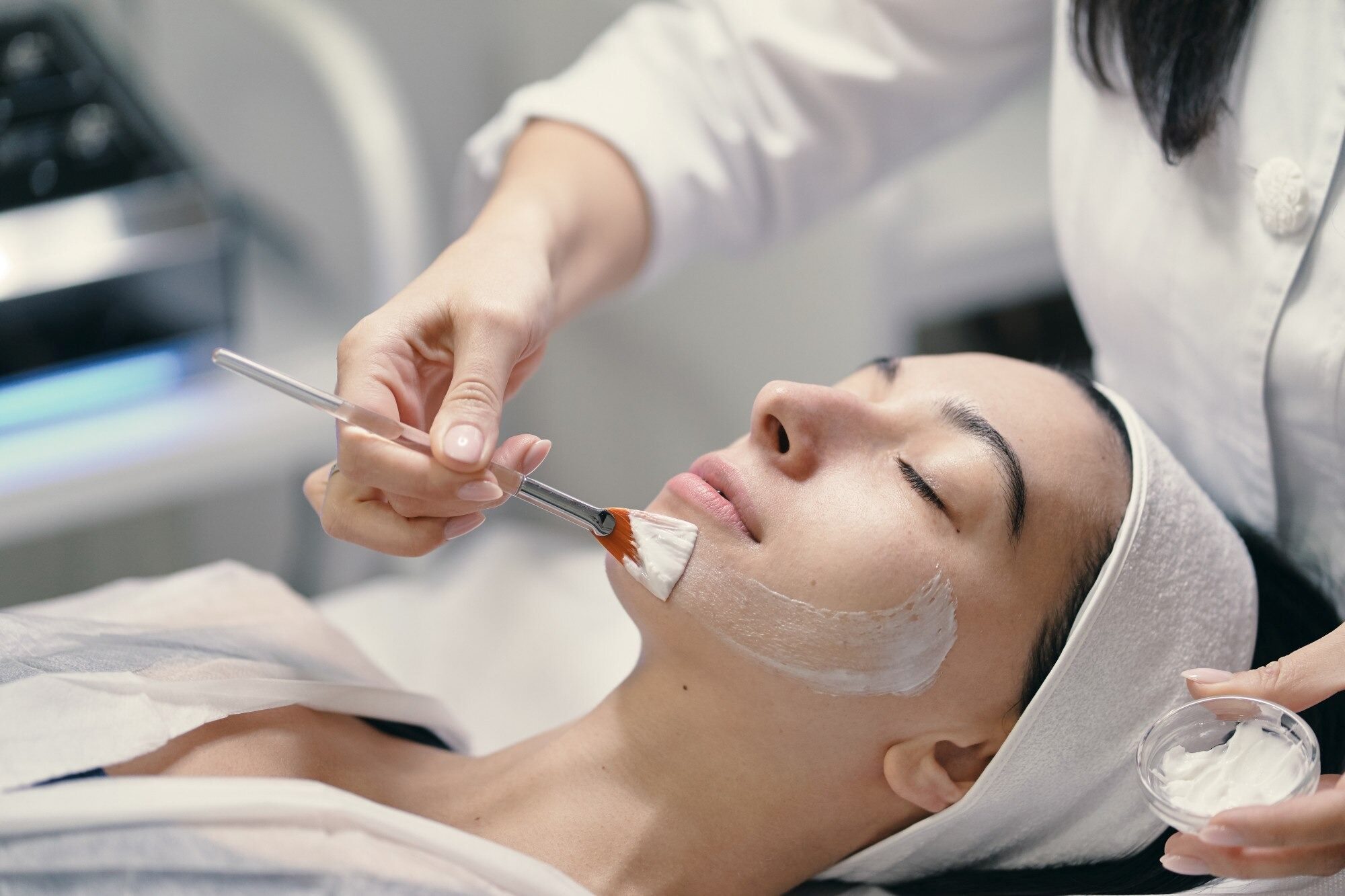 Chemical Peels