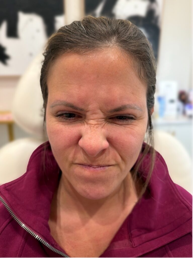 Galbella-Before-1