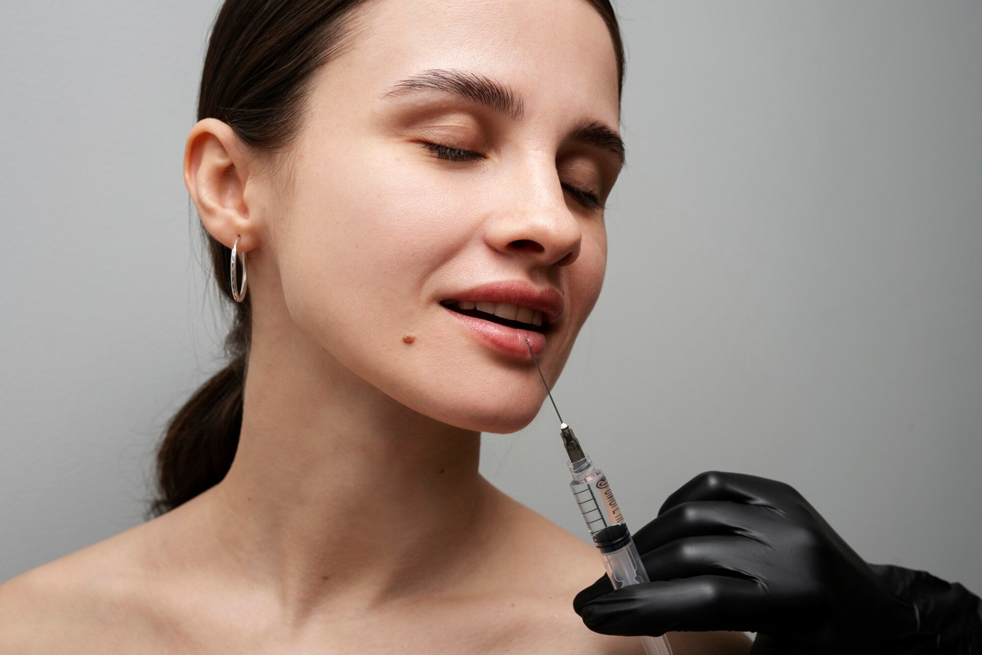 Close-up of a woman with eyes closed as a clinician in black gloves prepares a syringe near her lips for a cosmetic lip injection.