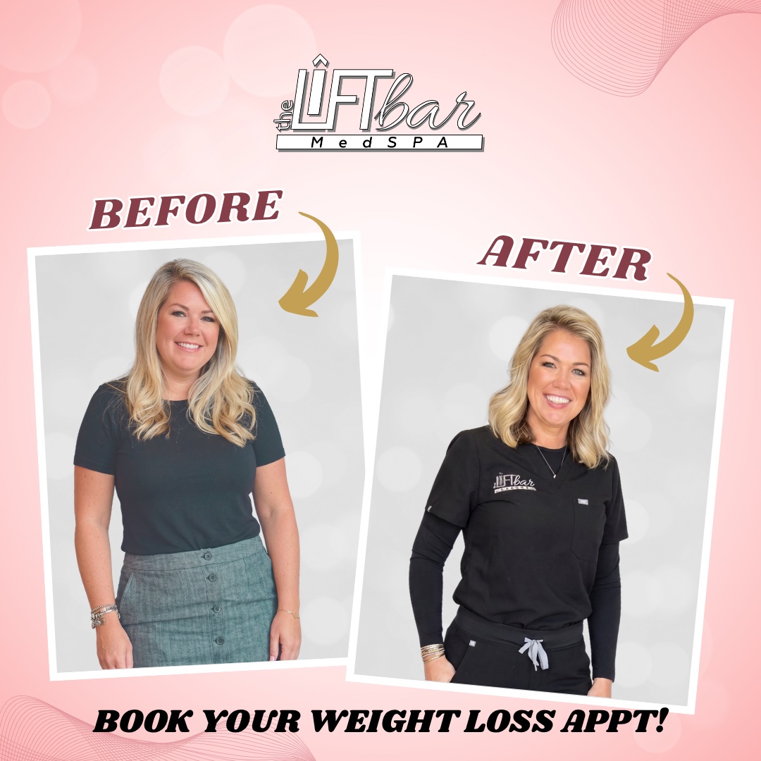 Before and after photos of a smiling woman promoting weight‑loss services at The Lift Bar Med Spa on a pink gradient background with the logo at the top center.