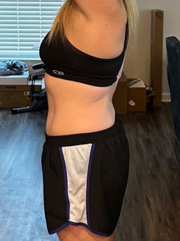 after22