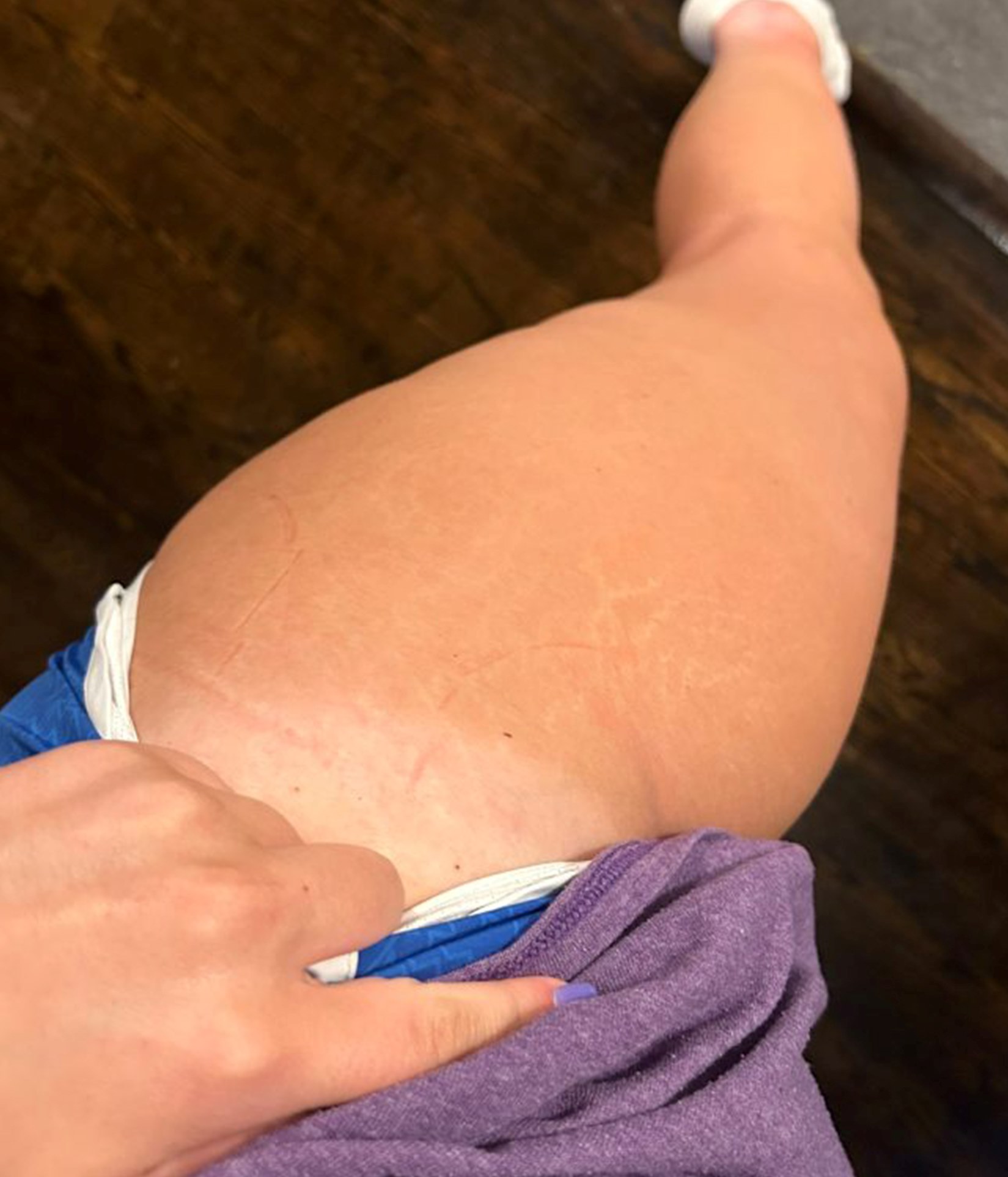 Close-up of a bare forearm and elbow resting on a purple towel.