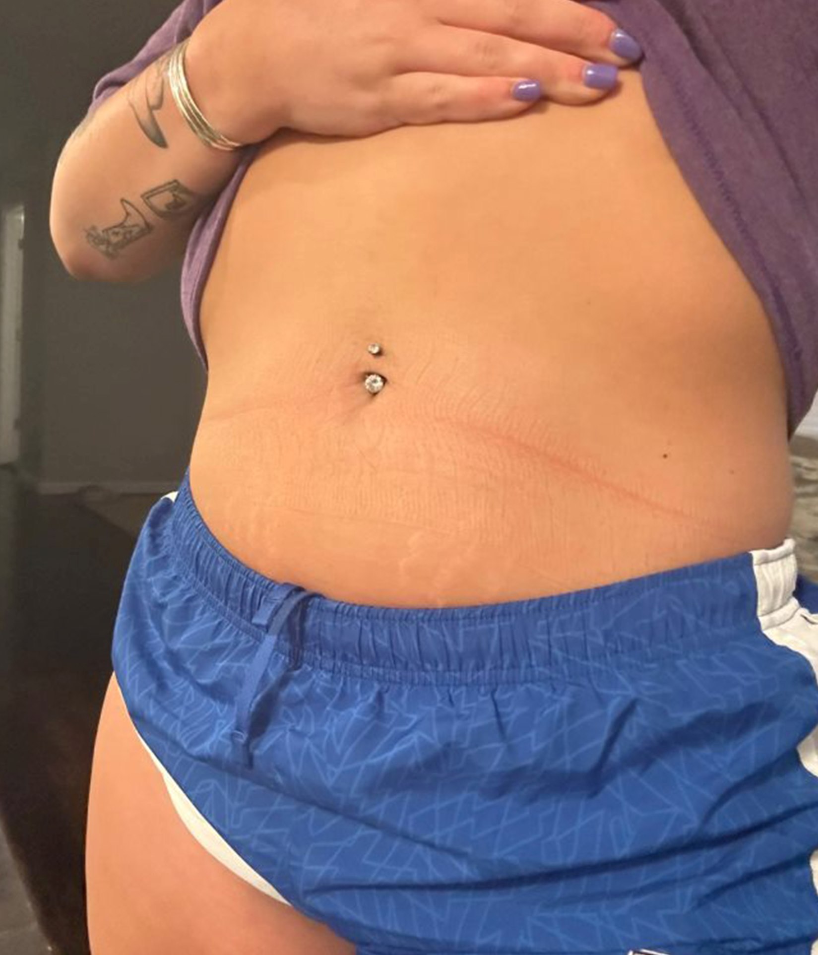 Close-up of a midriff with a double navel piercing, wearing blue shorts and a purple top, with a tattooed left arm nearby and purple nails.